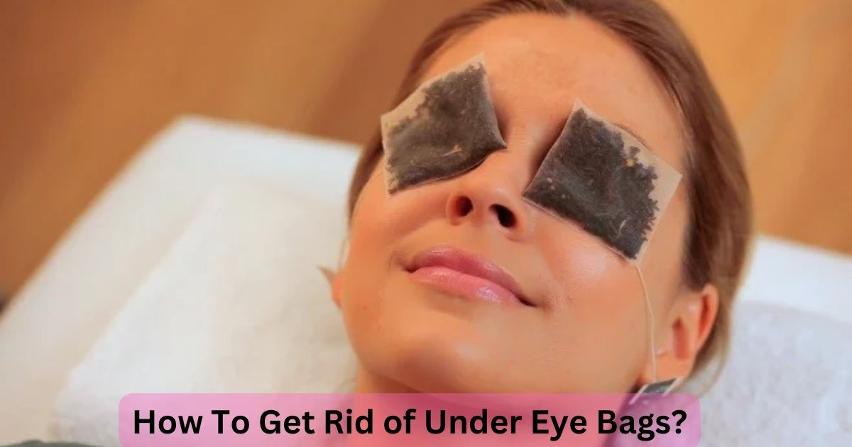 How To Get Rid of Under Eye Bags?